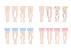 XO脚の原因とは